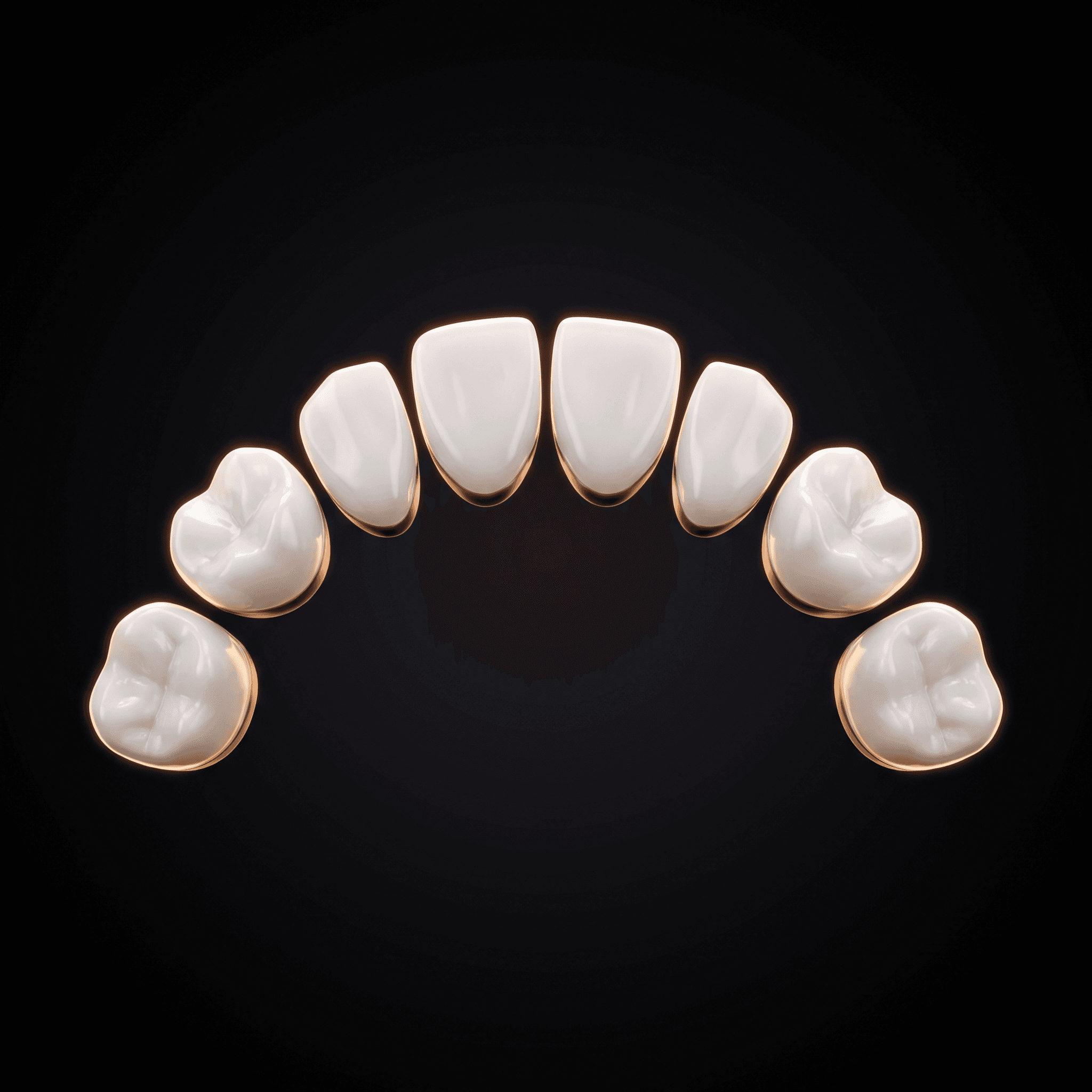 Full Mouth Rehabilitation