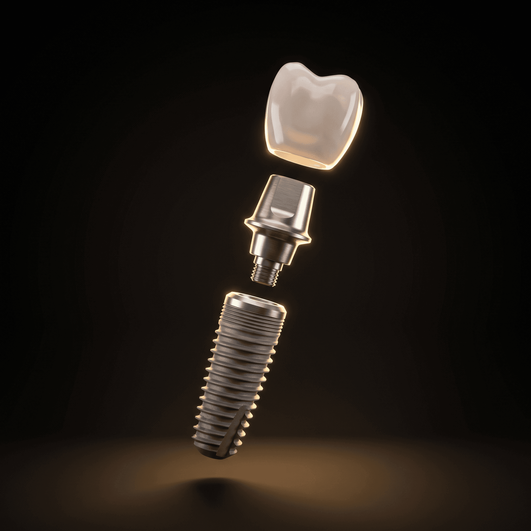 Dental Implants