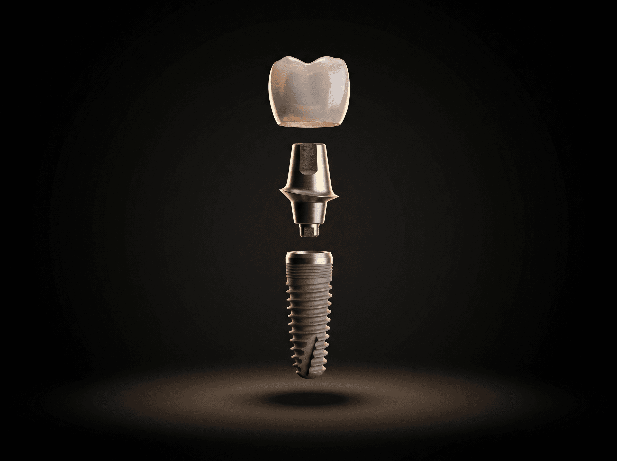 Dental Implants