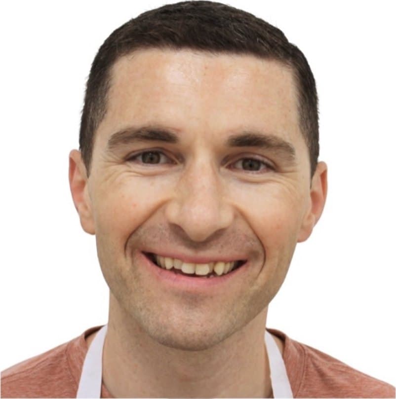 SureSmile clear aligners — before treatment